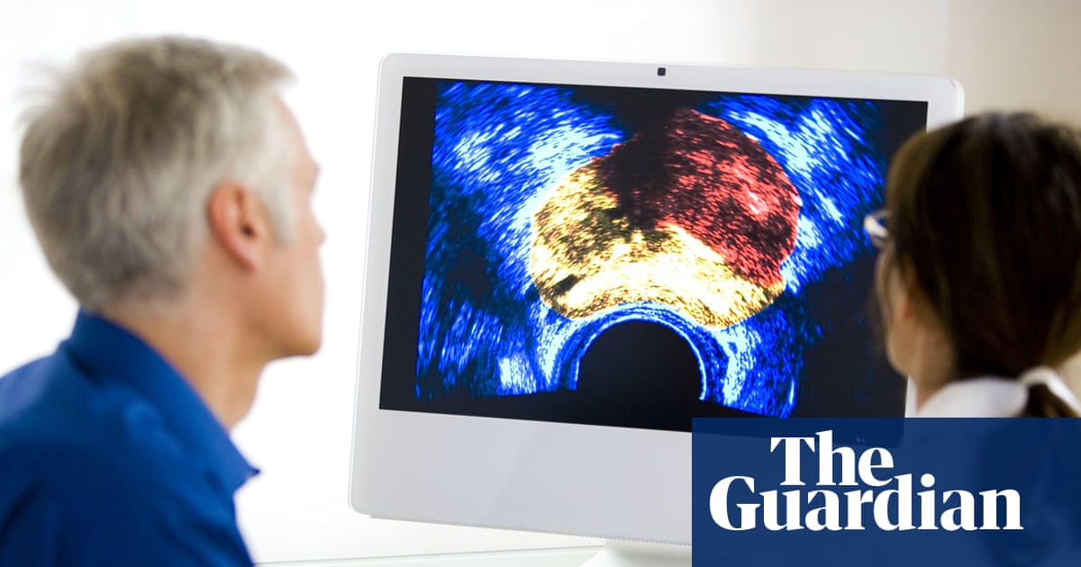 Prostate cancer is most commonly diagnosed cancer across UK, study finds