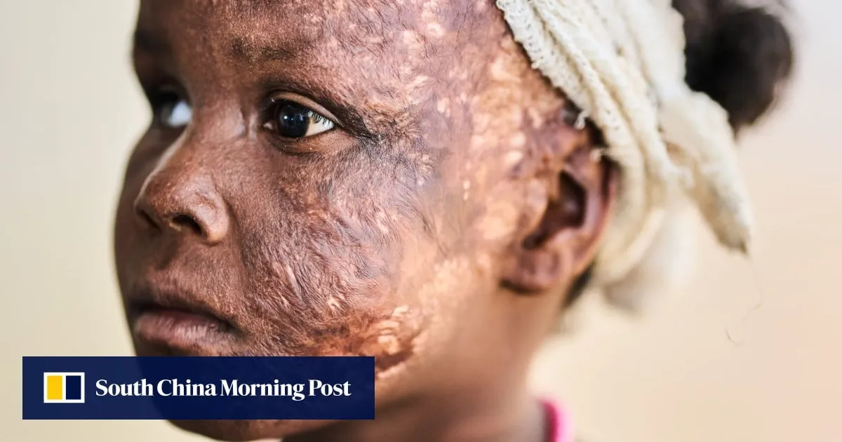 Sudan’s RSF committed ethnic cleansing, says Amnesty