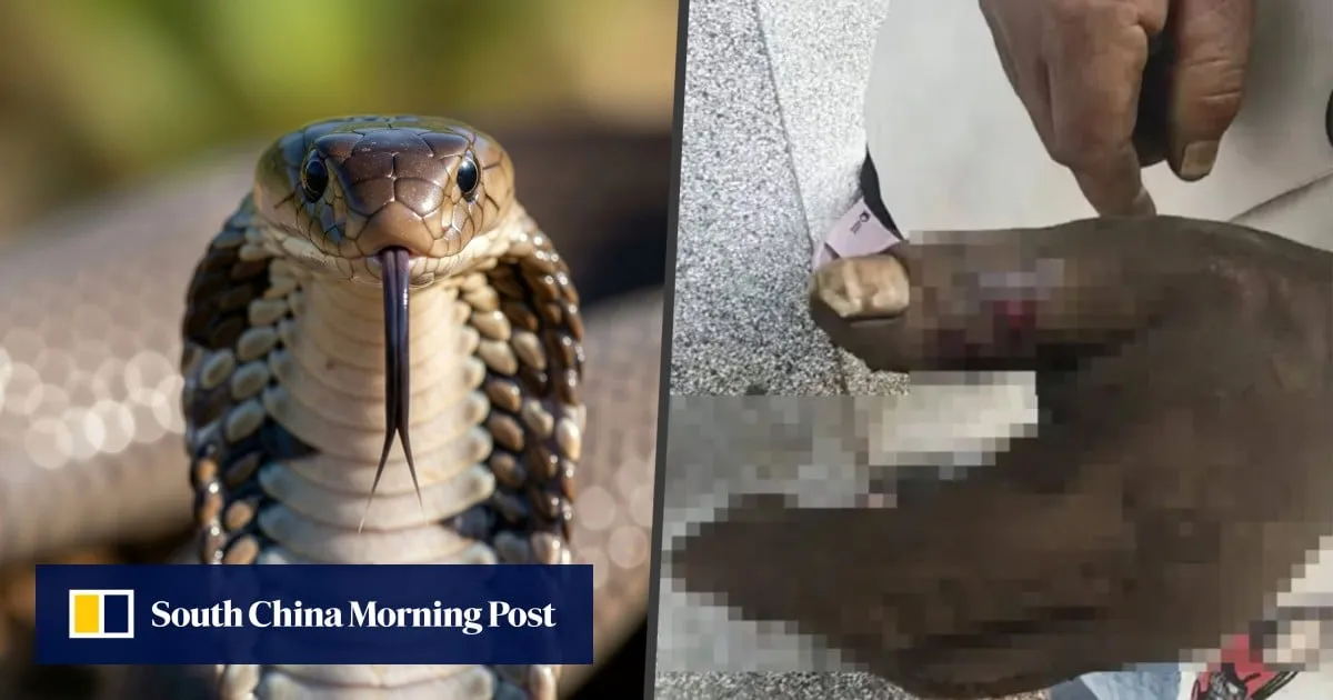 Chinese wife sucks venom from husband’s hand after cobra bite, ending up poisoning herself