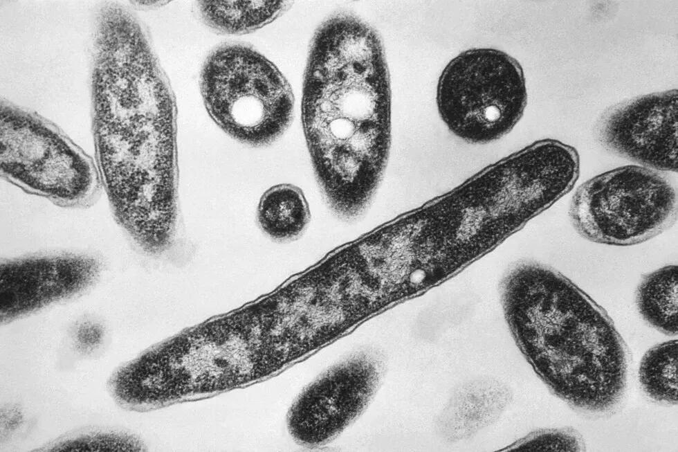 What to know about Legionnaires’ disease making people sick on New York’s Upper East Side