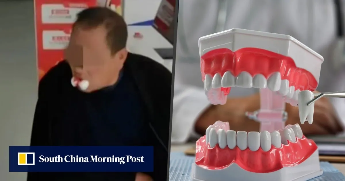 Chinese clinic extracts 12 teeth from man after he complains of ache in one tooth