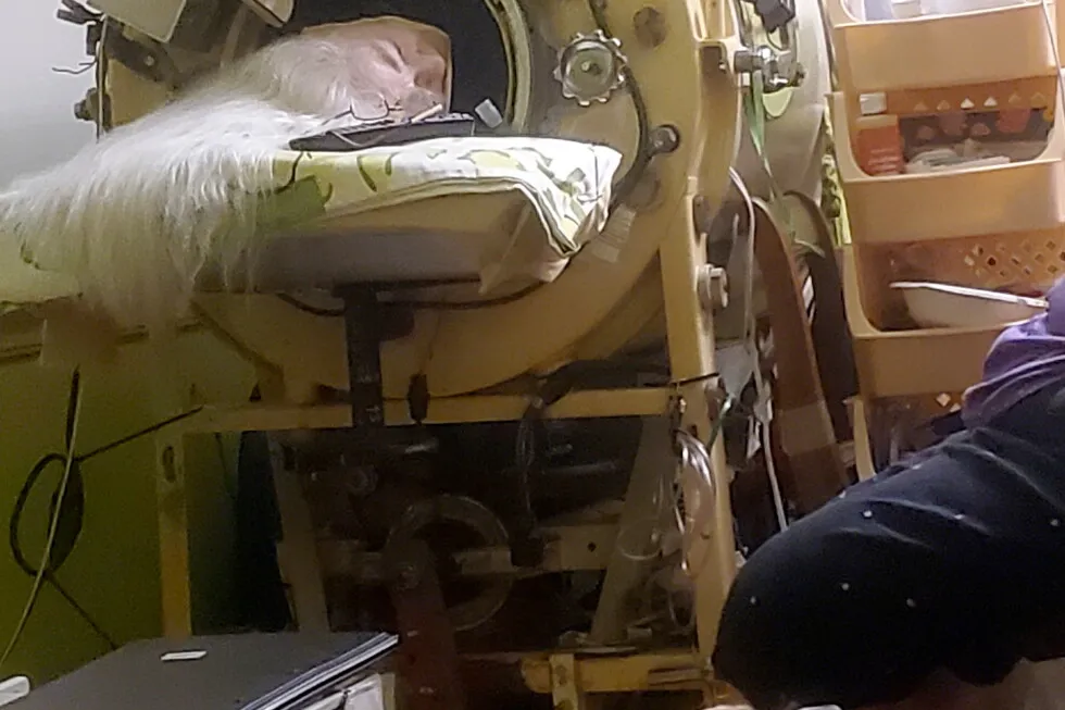 Martha Lillard, last US polio patient using iron lung, dies at 78 in Oklahoma
