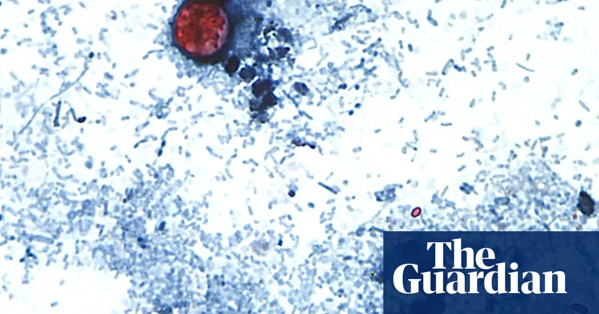 US outbreak of parasite causing ‘watery diarrhea’ rises to more than 2,800 cases