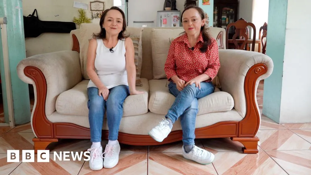 How these twins' rare growth disorder could provide the key to preventing cancer