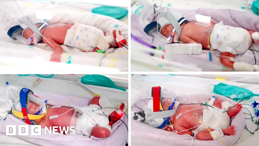 Rare identical quadruplets born in Australia