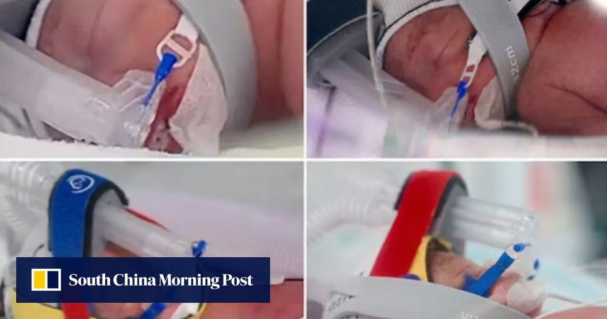 ‘1 in 15 million’: woman in Australia gives birth to identical quadruplet girls