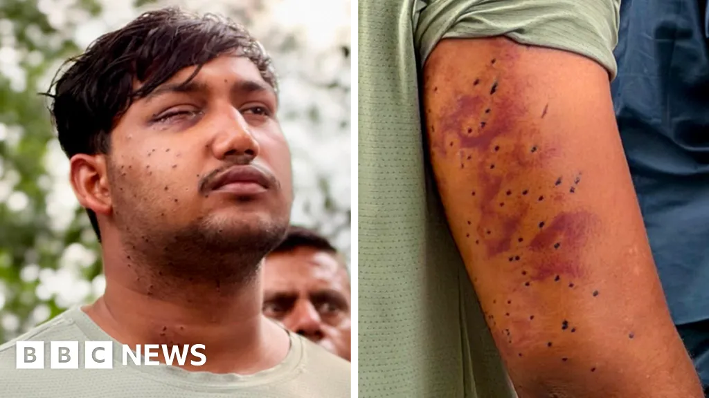 India's 'cockroach' protesters have wounds consistent with pellet-gun fire, say experts